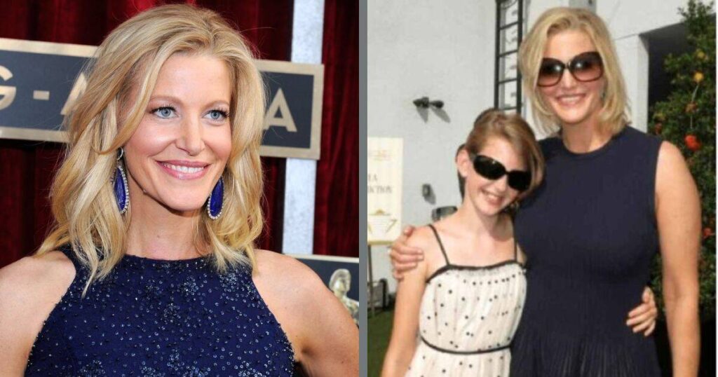 Eila Rose Impact on Anna Gunn's Life and Career
